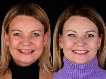 Wzrosła moja pewność siebie, bo... nic już nie mam do ukrycia