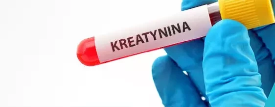 Probówka z&nbsp;krwią na badanie stężenia kreatyniny. 