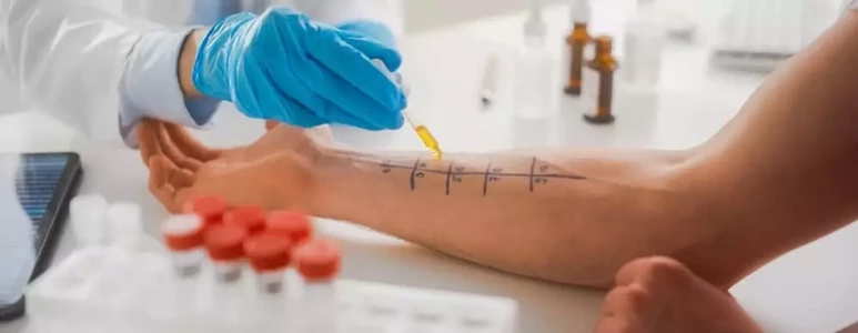 jakie-testy-alergiczne-najlepiej-zrobic