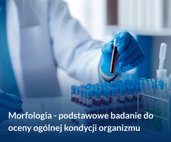 Morfologia krwi pełna - podstawowe badanie do oceny ogólnej kondycji organizmu. Przygotowanie, cena 
