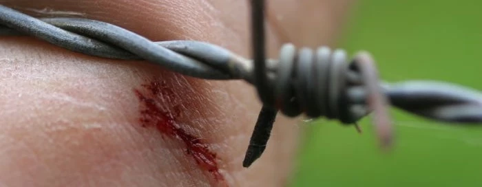 Tężec wywołuje laseczka tężca - Clostridium tetani