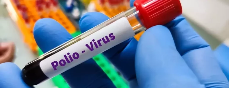 grozny wirus polio