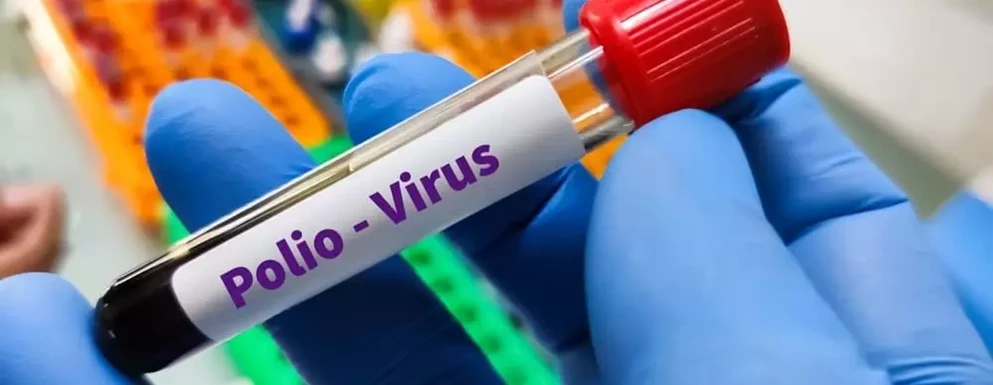 grozny wirus polio