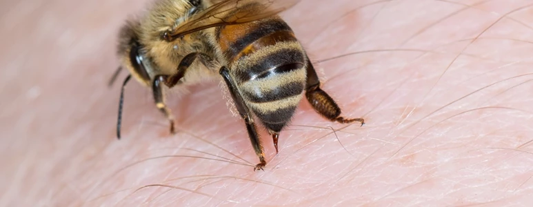 Alergia na jad owadów