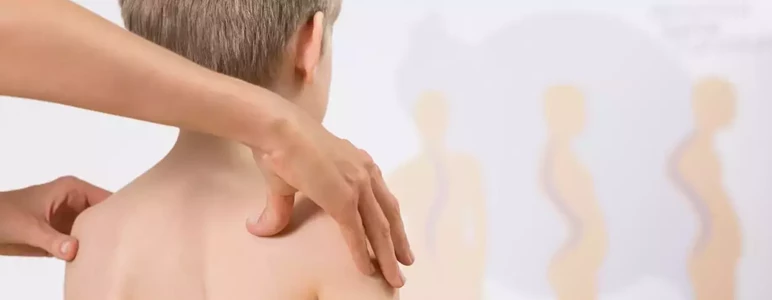 Skolioza
