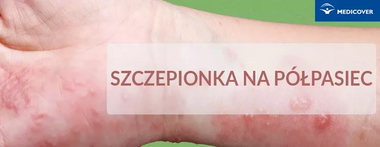 Szczepienie przeciwko półpaścowi jest skuteczną formą ochrony