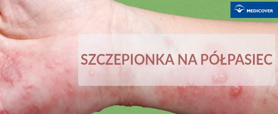 szczepionka na półpasiec