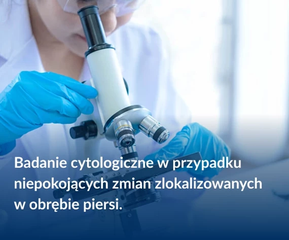 Badanie cytologiczne w przypadku niepokojących zmian zlokalizowanych w obrębie piersi.
