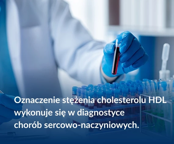 Oznaczenie stężenia cholesterolu HDL wykonuje się w diagnostyce chorób sercowo-naczyniowych.