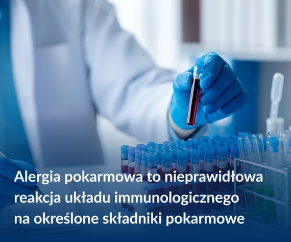 Alergia pokarmowa badanie