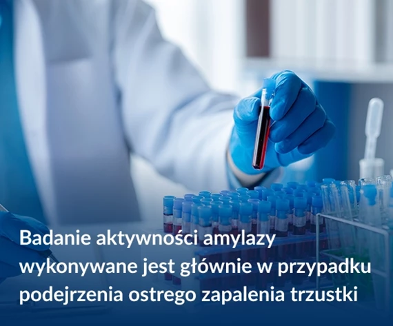 Badanie aktywności amylazy wykonywane jest głównie w przypadku podejrzenia ostrego zapalenia trzustki