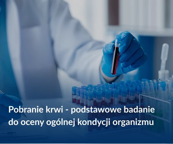 pobieranie krwi badanie
