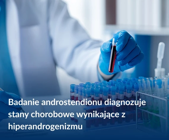 Badanie androstendionu diagnozuje stany chorobowe wynikające z hiperandrogenizmu