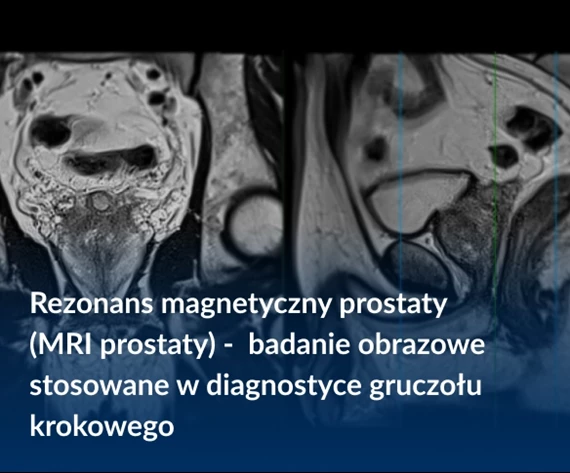 rezonas prostaty badanie