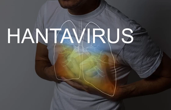 Hantawirus – objawy, zakażenie i&nbsp;leczenie. Czy jest groźny w&nbsp;Polsce?