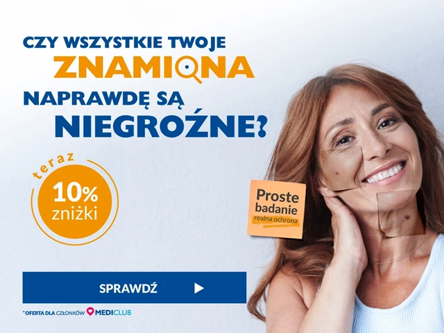 Czy wszystkie Twoje znamiona naprawdę są niegroźne? Teraz 10% zniżki na wideodermatoskopię